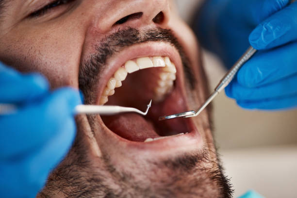 Best Emergency Treatment for Toothache in Wakefield, VA